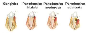 Parodontologia2